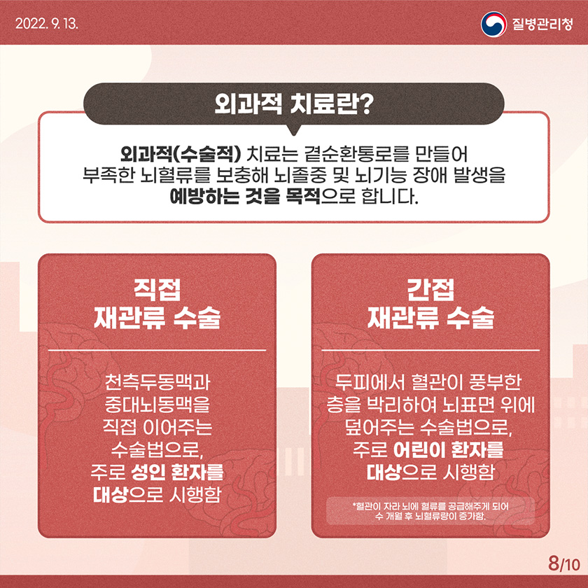 [2022년 9월 13일 질병관리청] 외과적 치료란? 외과적(수술적) 치료는 곁순환통로를 만들어 부족한 뇌혈류를 보충해 뇌졸중 및 뇌기능 장애 발생을 예방하는 것을 목적으로 합니다. 직접 재관류 수술: 천측두동맥과 중대뇌동맥을 직접 이어주는 수술법으로, 주로 성인 환자를 대상으로 시행함. 간접 재관류 수술: 두피에서 혈관이 풍부한 층을 박리하여 뇌표면ㅁ 위에 덮어주는 수술법으로, 주로 어린이 환자를 대상으로 시행함. *혈관이 자라 뇌에 혈류를 공급해주게 되어 수 개월 후 뇌혈류량이 증가함. [10페이지 중 8페이지]